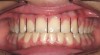 Figure 2   A balanced appearance of the anterior teeth is represented by a 