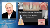 The Implant-Occlusal Connection Webinar Thumbnail