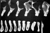 Figure 6  Tomograms showing natural teeth alignments on their bony bases (Wheeler R. Dental Anatomy, Physiology and Occlusion. 5th ed. Philadelphia, PA: WB Saunders; 1974:364).