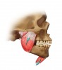 Figure 1  The mandible is in a sling of muscles that pull in opposite directions. When the muscles are in their resting stage, the teeth are separated. The space between the arches is called the freeway space. Anything (such as stress) that alters the balance between the opposing muscles changes the dimension of the freeway space.