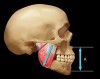 Figure 2  The vertical dimension of occlusion (VDO) is measured when the teeth are together in maximum intercuspation. The determinant of VDO is the elevator muscles. The dimension can be measured from zygoma to the angle of the mandible (B). The dimension at (A) can vary depending on the position of the condyles so (A) is not a reliable determinant for VDO.