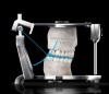 Figure 6  A primary reason for mounting casts in CR, with a face-bow to record the condylar axis, is to determine tooth-to-tooth relationships in CR at different vertical dimensions. This is the only practical way to evaluate both vertical and horizontal positioning of the lower teeth in relation to the upper teeth.