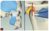 Fig 5. A stable occlusion contributes to the masticatory joints, muscles, teeth, condyles, and appropriate receptive system working in harmony to minimize stress and force.