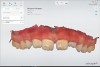 Fig 4. Scan used to create model for making a mouthguard.