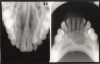 Figure 3 - Occlusal Images