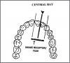 Figure 14 - Maxillary Central/Lateral Incisors