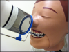 Figure 16 - XCP placement for Maxillary Central/Lateral Incisors