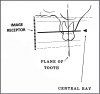 Figure 24 - Maxillary Molars