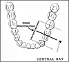 Figure 32 - Mandibular Premolars