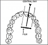 Figure 40 - Maxillary Central/Lateral Incisors
