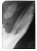 Figure 76 - Modified Oblique Posterior Mandibular Occlusal Image