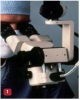 Fig 1. The surgical microscope was an early improvement in visualization. However, it is difficult to use in many intraoral sites. It is also cumbersome to adjust and requires constant compensation for patient movements during treatment.